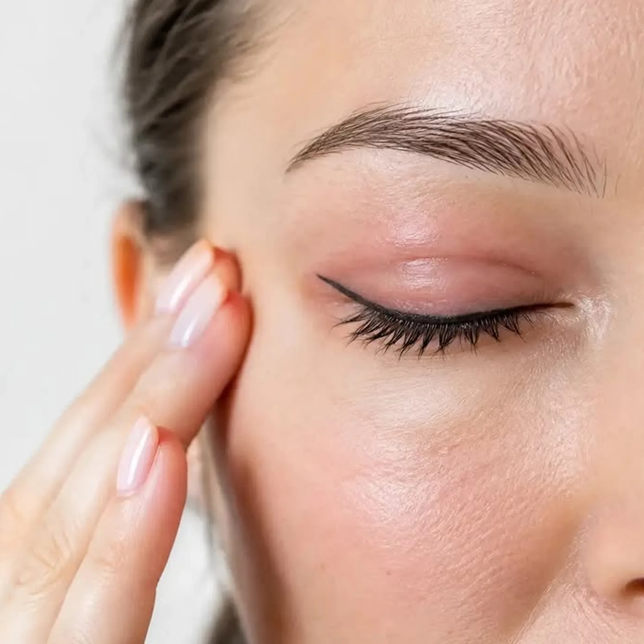 eyeliner with mild eyelid swelling